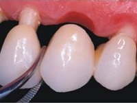 Laboratório de Prótese Dentária Andreense